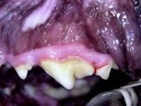 periodontal disease stage 1