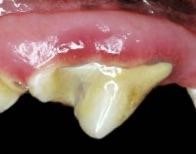 periodontal disease stage 2